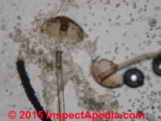 Rhizopus sporangium and Rhizopus oryzae fungal spores (C) Daniel Friedman